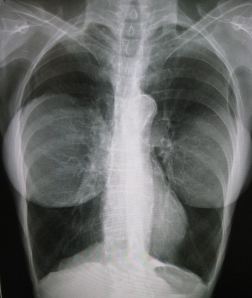 slut-shamed by an X-ray